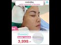 ร้อยไหม