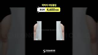 양쪽 허벅지 붙는 사람, 여기 보세요!