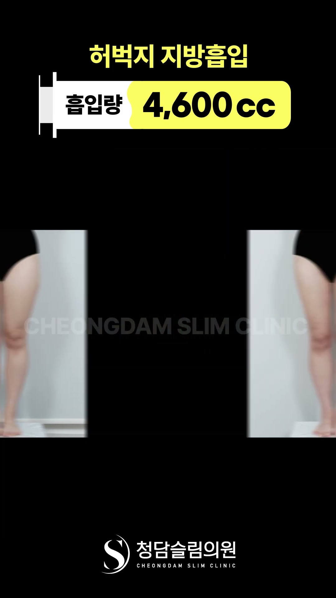 양쪽 허벅지 붙는 사람, 여기 보세요!