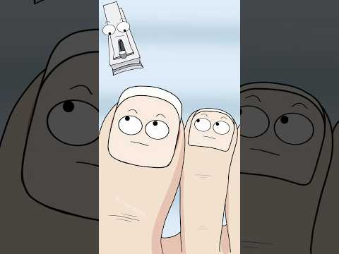 How Cutting Your Toenails Can Cause an Ingrown Toenail