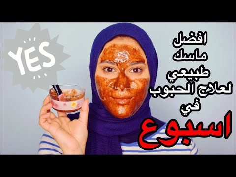 اتخلصي من الحبوب ف اسبوع واحد بس بحاجات طبيعية من البيت | DIY ACNE FACE MASK هنا hana