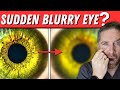 Sudden Blurry Vision In One Eye 5 Causes