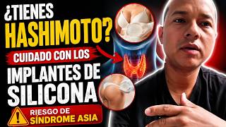 ¿Tienes Hashimoto? Cuidado con los Implantes de Silicona | Síndrome ASIA