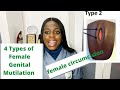 4 Types Of Female Genital Mutilation You Should Know