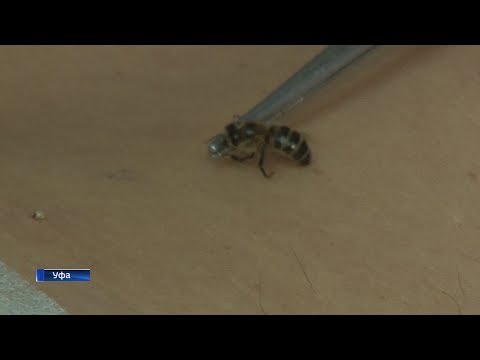 Лечение позвоночника на варшавке Хрустят суставы в колене что делать