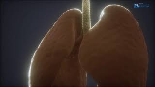 Akciğer Kanserinde Işın Tedavisi (Radyoterapi)
