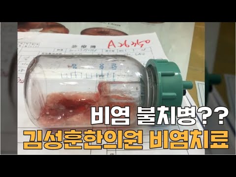비염 불치병인가