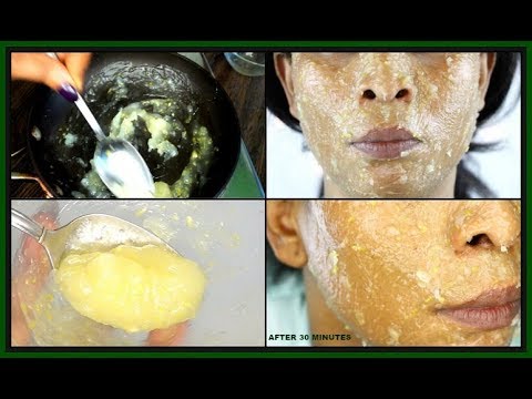 LEMON HONEY FACE MASK FOR SCARS, ACNE AND DARK SPOTS | BRIGHTEN AND HYDRATES THE SKIN |Khichi Beauty