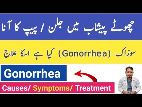 Gonorrhea Causes Symptoms and Treatment In Urdu Hindi - Gonorrhea Ka Ilaj -Suzak Ka Ilaj Irfan Azeem