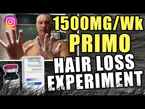 1500 MG Per Week Primobolan Hair Loss Experiment