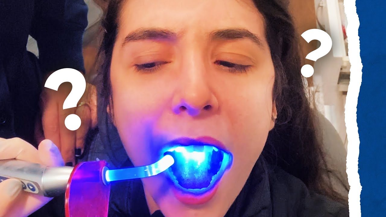 Pra que serve a LUZ AZUL do dentista?