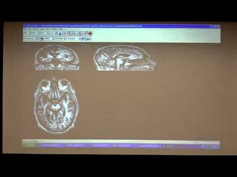 VLSM Mini course (Session 2) 6 of 7