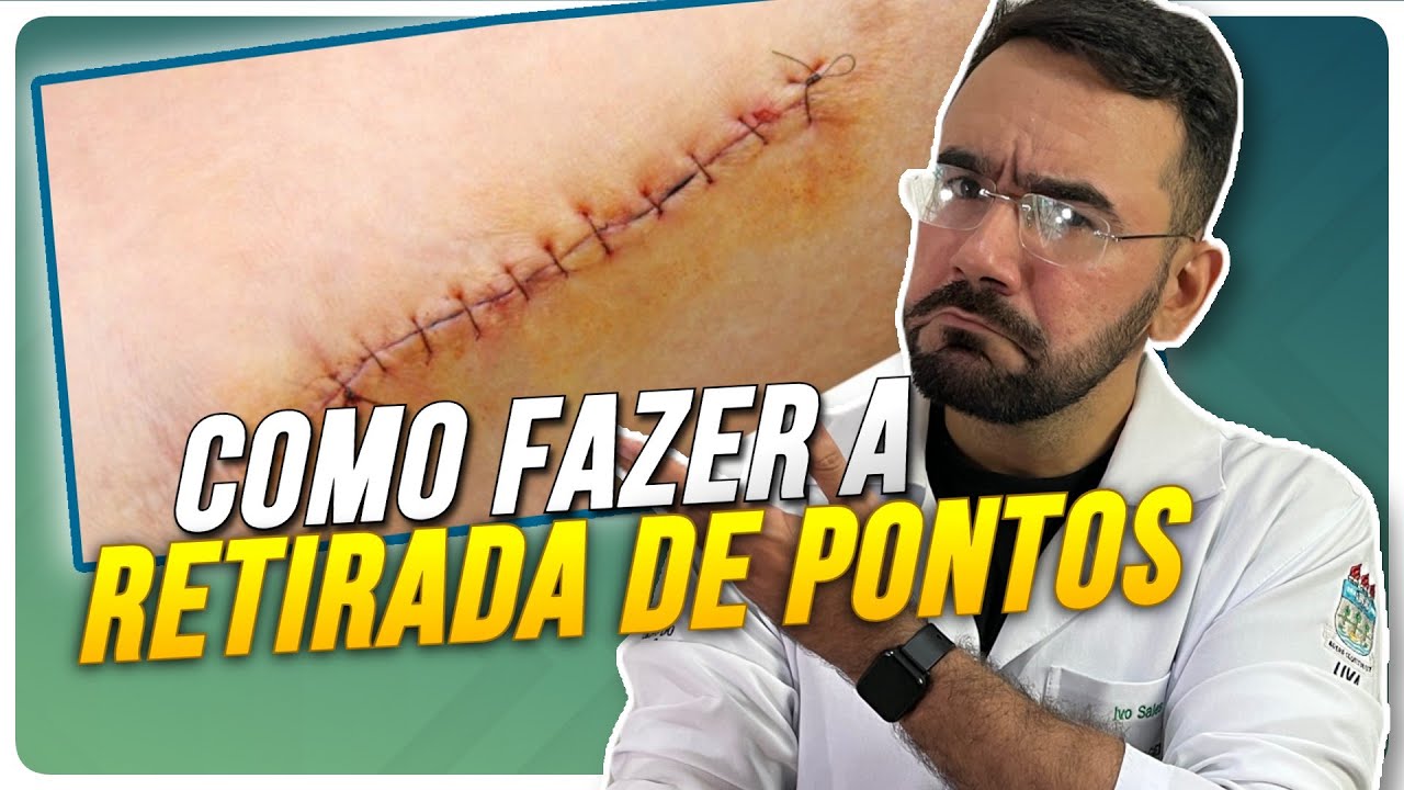 COMO RETIRAR PONTOS DE SUTURA DA FORMA CERTA E ATUALIZADA