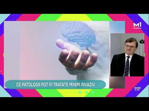 Intervențiile minim invazive pe creier explicate de neurochirurgul prof. Grigore Zapuhlîh