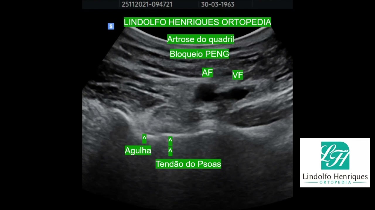 Lindolfo Henriques-13