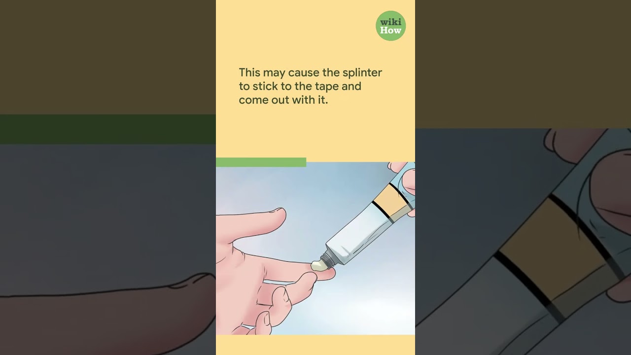How to Get a Splinter Out #shorts