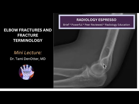 RADIAL HEAD/NECK FRACTURES, IDENTIFYING OCCULT ELBOW FRACTURE: Mini Lecture, Dr. Tami DenOtter, MD