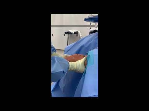 Alexander E Weber, MD