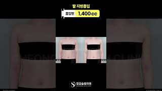 여리한 팔 만드는 포인트💡