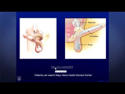 Erectile Dysfunction Solutions after Prostate Cancer Treatment
