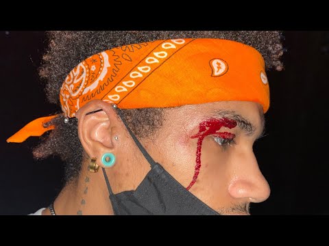 EXPLORING ABANDON QUARRY (QUINCY QUARRIES! I CUT OPEN MY EYE)!