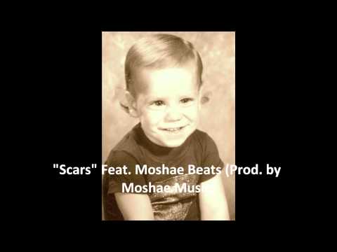 Scars Feat. Moshae Beats (Prod. by Moshae Music)