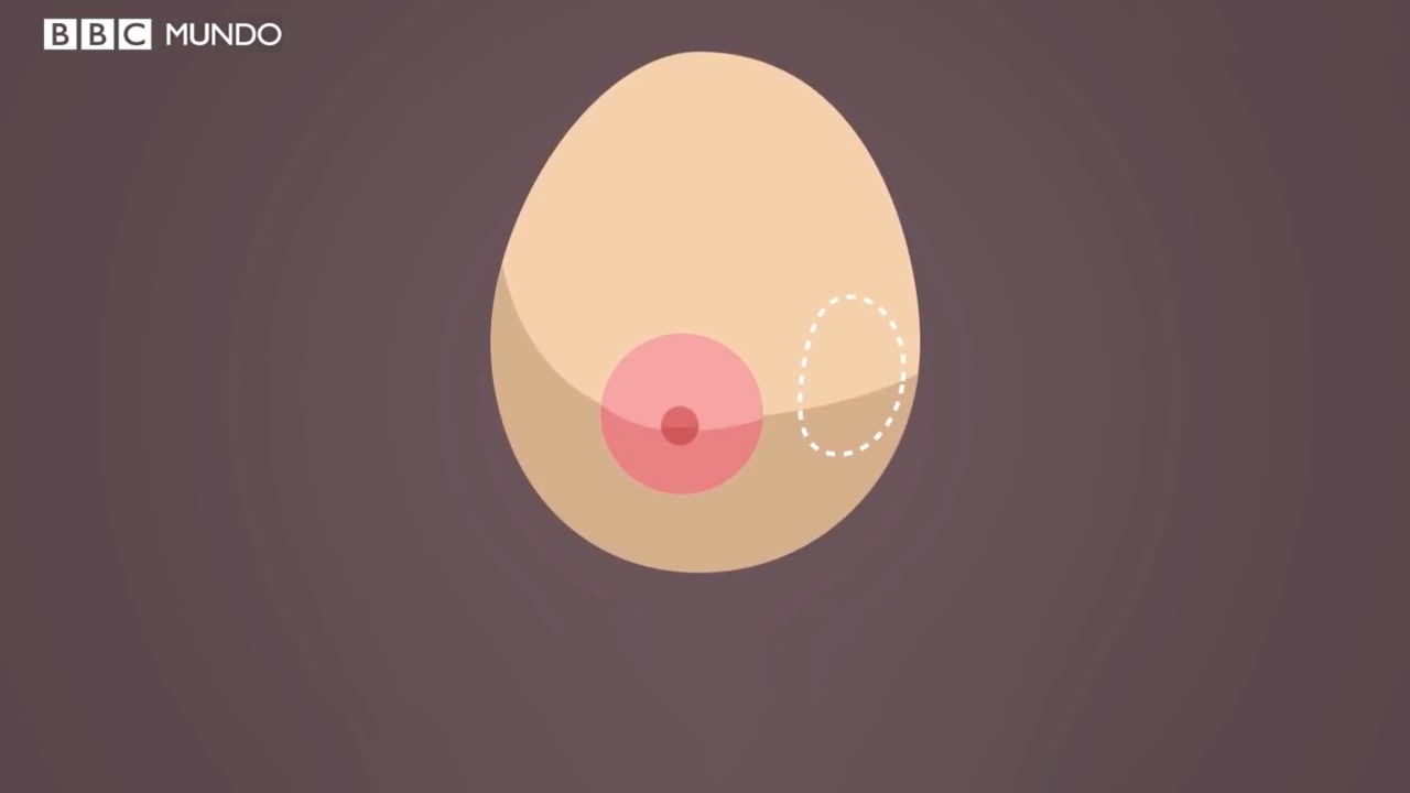 Watch 12 síntomas para detectar el cáncer de mama, el más común entre las mujeres Now 12 síntomas para detectar el cáncer de mama, el más común entre las mujeres