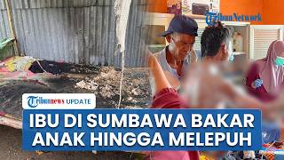 Kronologi Ibu di Sumbawa Bakar Anak Kandung hingga Melepuh gegara Menolak Cari Rumput untuk Ternak