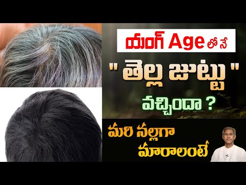 Causes of White Hair at Younger Age | How to Turn White Hair to Black Hair | Dr.Manthena Health Tips