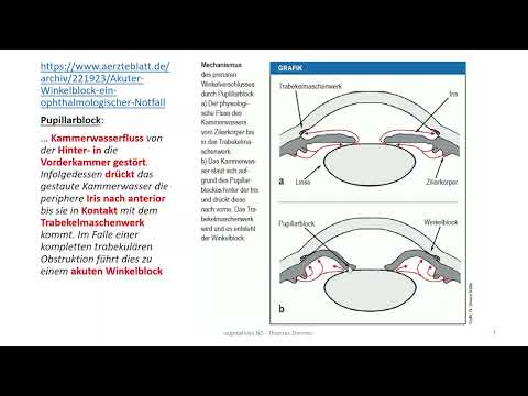Autonomes Nervensystem 13: Glaukom II - Engwinkelglaukom / Pharmakologie + Pathophysiologie