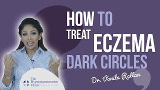 How to Treat Eczema Dark Circles for darker Skin. Avoid Common Mistakes Made by Doctor Vanita Rattan