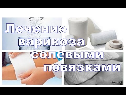 Как укрепит связки коленных суставов Шишка на ноге болит сустав