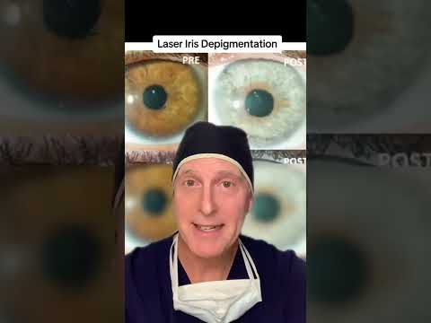 Safe to Have Eye Color Change???