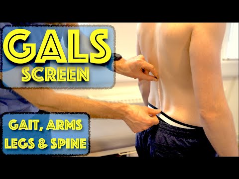 GALS Screen - Gait, Arms, Legs and Spine - GALS Examination Musculoskeletal Screen - Dr Gill