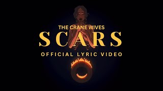 Download lagu Scars mp3 Download lagu Scars mp3