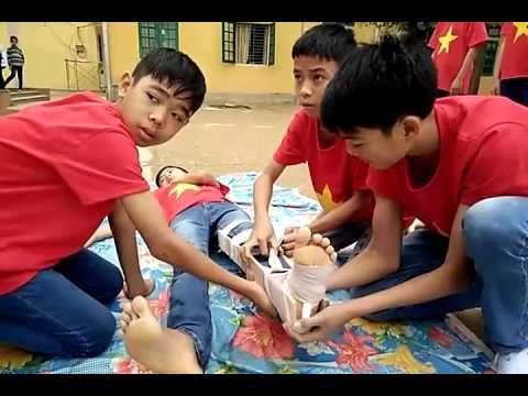 Kỹ thuật sơ cứu gãy xương cẳng chân HS THCS Hà Thạch TX Phú Thọ