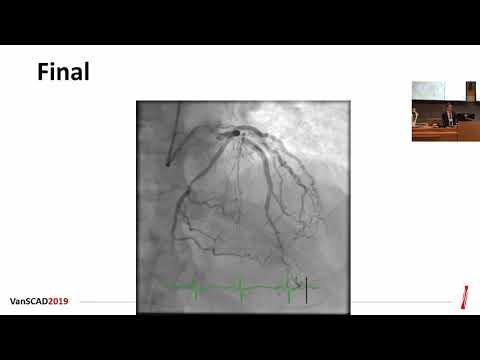 Rinfret CTOtechniques VanSCAD2019