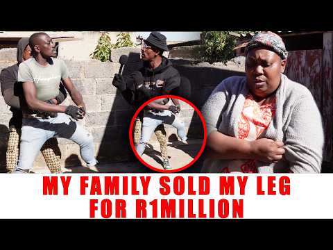 Ep 6922 My Family Sold My Leg For R1Million