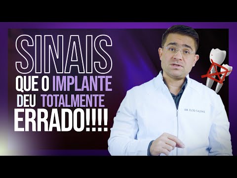 Sinais que o Implante dentário deram ERRADO!  - Virou um pesadelo  após a cirurgia para paciente