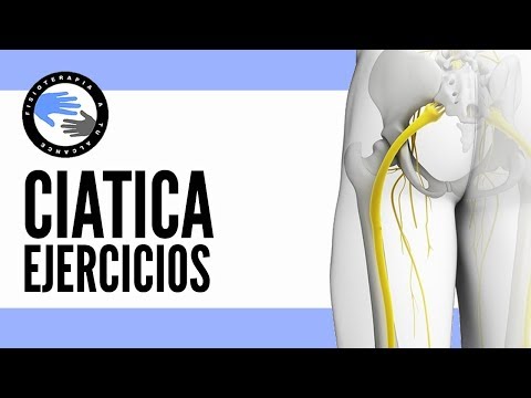 Ciatica, ejercicios para alivar el dolor