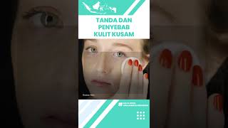 Inilah Tanda dan Penyebab Kulit Kusam yang akibatkan Penuaan Dini: Penumpukan Sel Mati