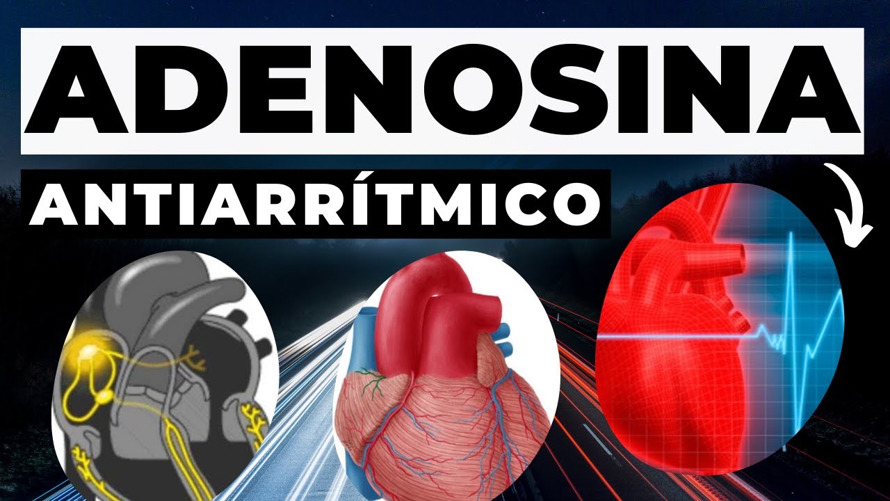 ADENOSINA: Apresentação, mecanismo de ação,  indicação, reações, interação e cuidados de #enfermagem