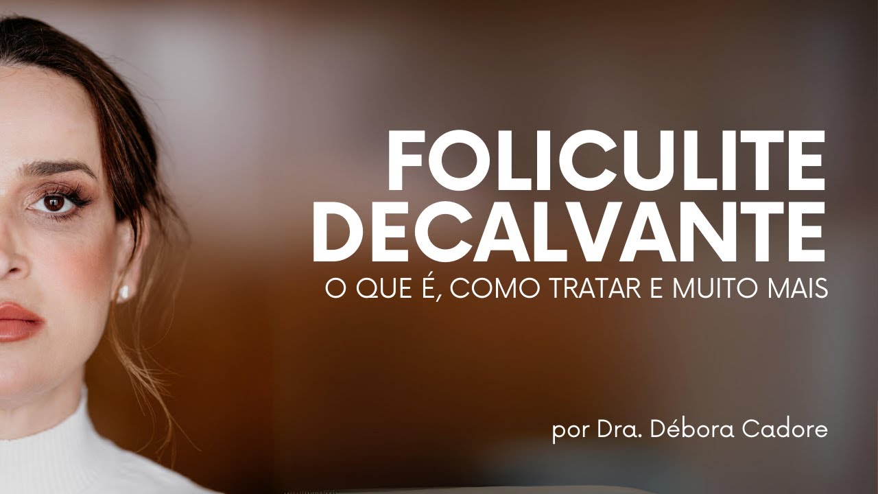 Foliculite Decalvante: o que é e como tratar essas espinhas no couro cabeludo | Dra. Débora Cadore