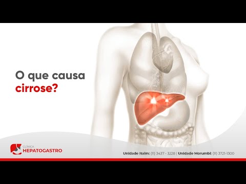 O que causa cirrose? | Clínica Hepatogastro