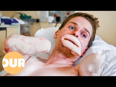 The Incredible Story Of Alex Lewis | Our Life