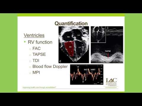 Pediatric Echo Quantification: To Z or Not To Z