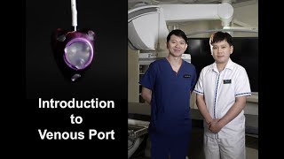 Introduction to Port Implantation