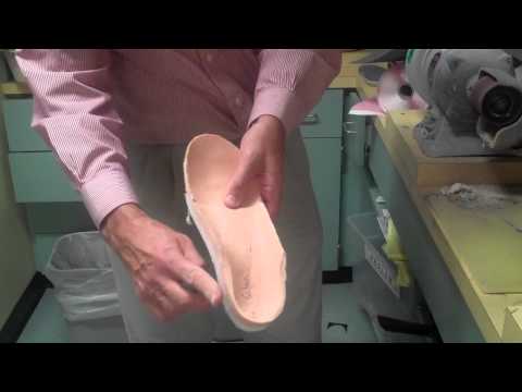 The rough grind of the hannaford orthotic device