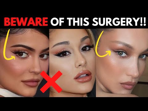Why You'll REGRET Getting this Trendy Plastic Surgery Procedure (Fox eye surgery trend)