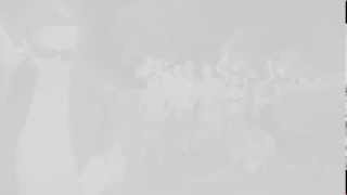 Scelo Street Boyz - Pearl Jam - Black (REMIX)